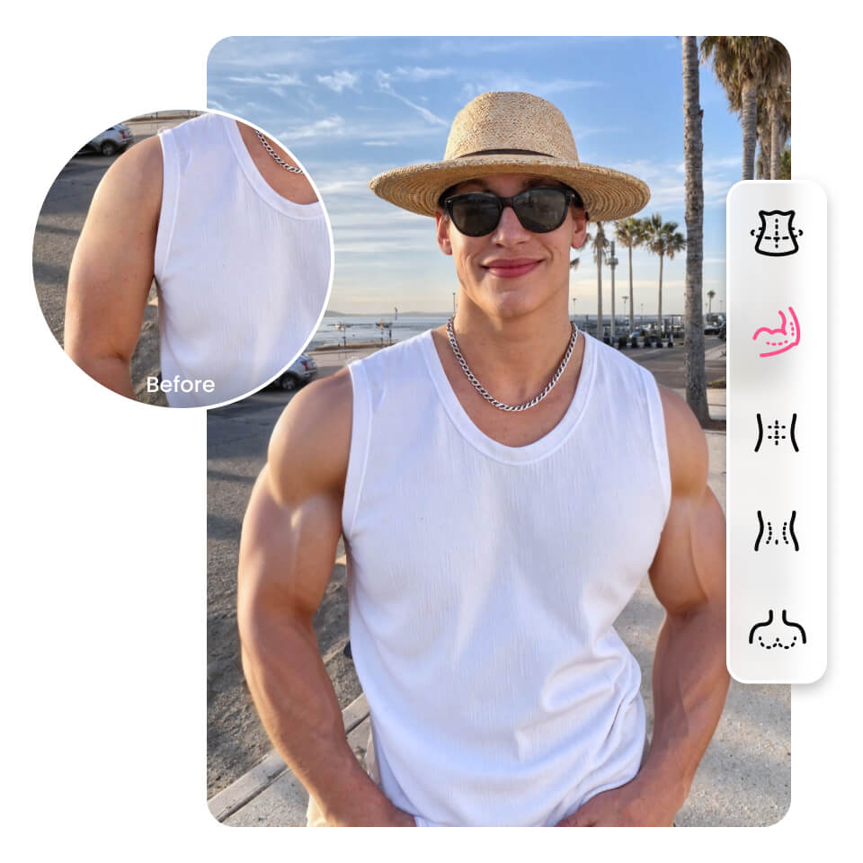 muscle.scenary1.img.alt.1