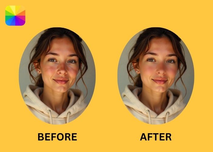 Blemish Removers-fotor before and after