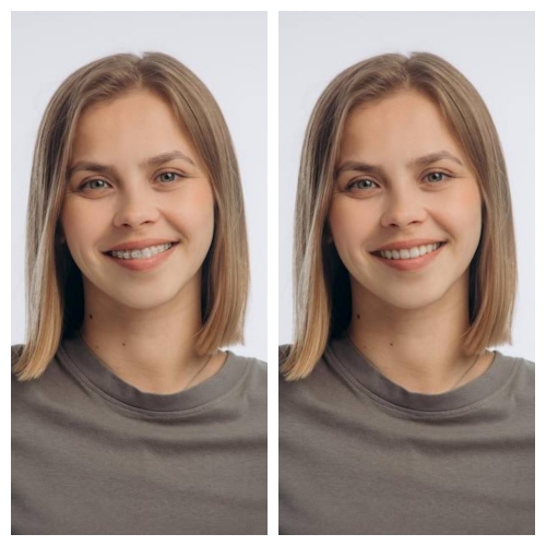 No-Brace Filter - Beautyplus before after