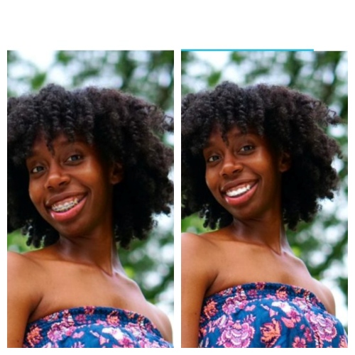 No-Brace Filter - Facetune before after