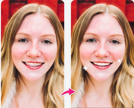 No-Brace Filter - YouCam before after