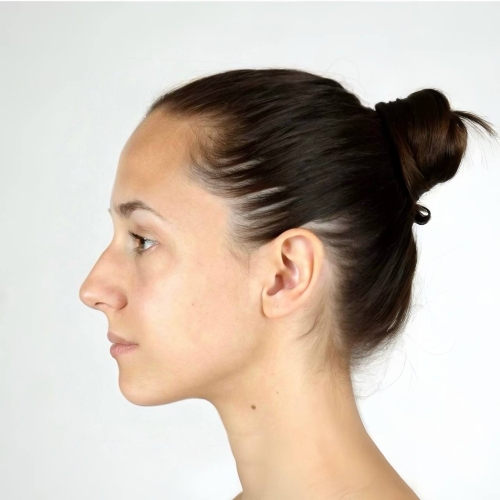 Nose Job Filter - side before