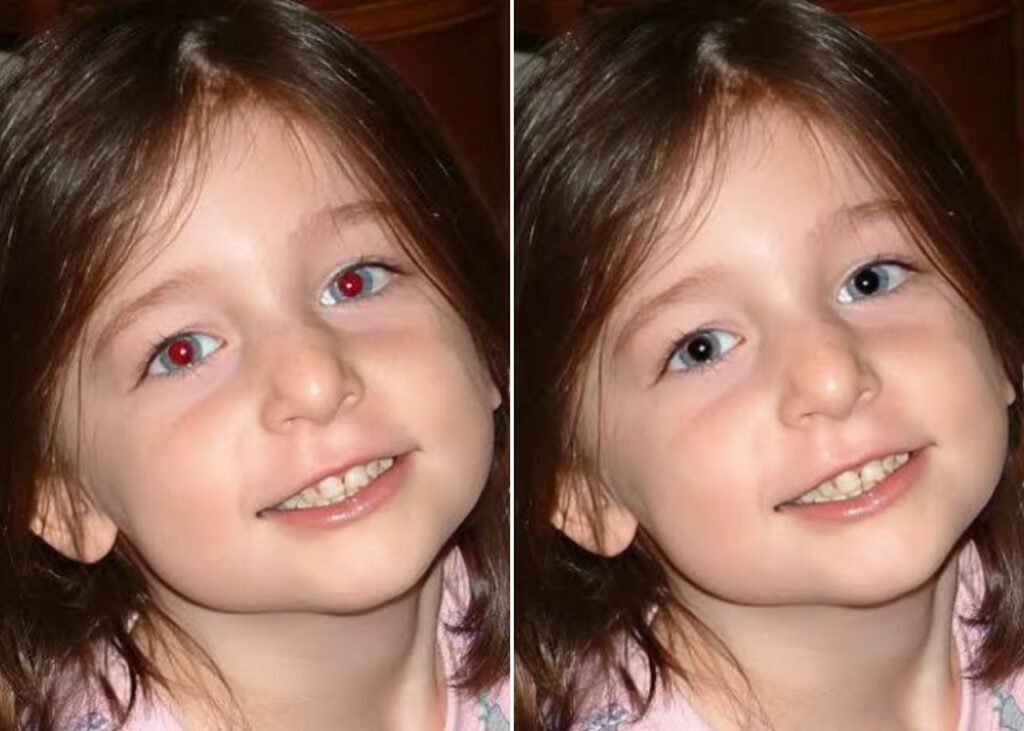 red eye remover-ba image