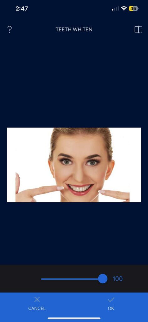 Teeth Whitening app-Apple Teeth Whitener 2